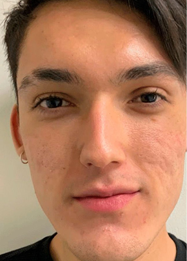 Angel Martínez